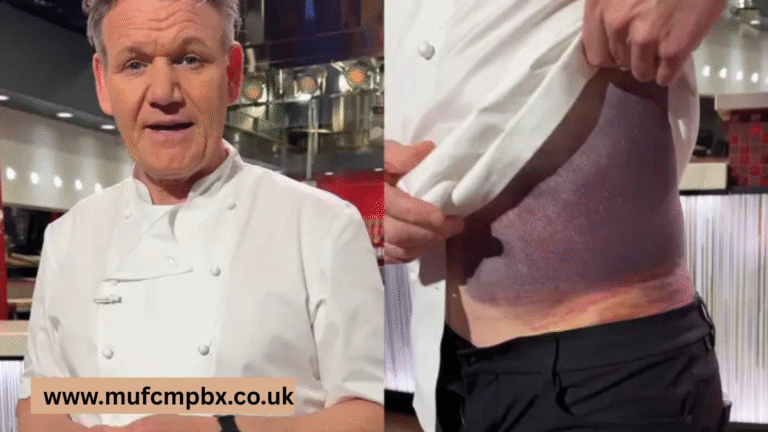 Gordon Ramsay Bike Accident: Rumors, Reports, and What We Know So Far gordon ramsay bike accident